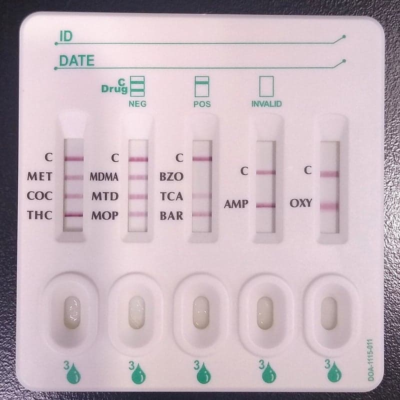 Prueba antidoping